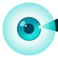 YAG Peripheral Iridotomy (YAG PI) Icon